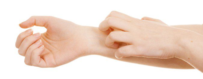 En muchas ocasiones las reacciones alérgicas comienzan con picores