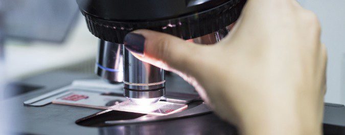 Algunos tipos de cáncer se pueden detectar cuando aún se encuentran en fase in situ