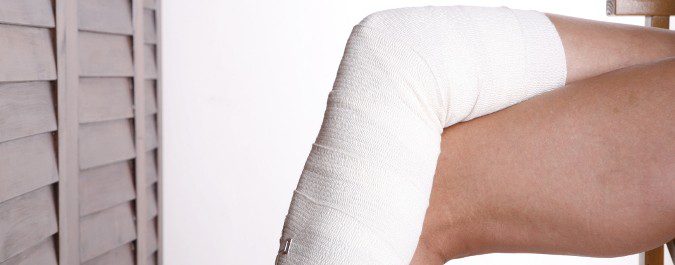 Las medias de comprensión o las vendas son frecuentes tratamientos para las varices