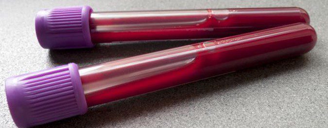 Antes de realizar la biopsia para el diagnóstico se analiza la sangre del enfermo