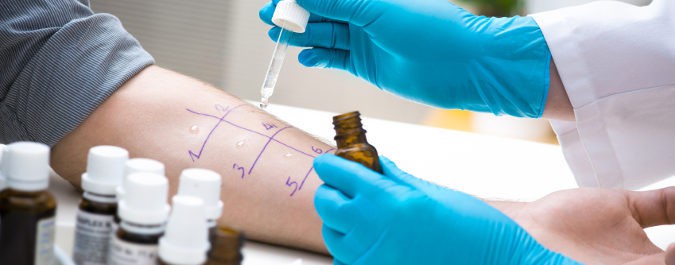 Cuando los síntomas de la alergia son fuertes debemos acudir al médico especialista