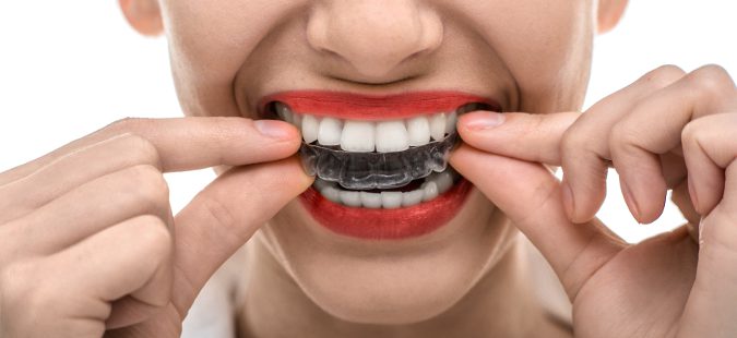 Corrector dental