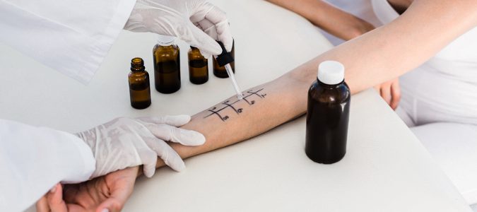 Pruebas de alergia