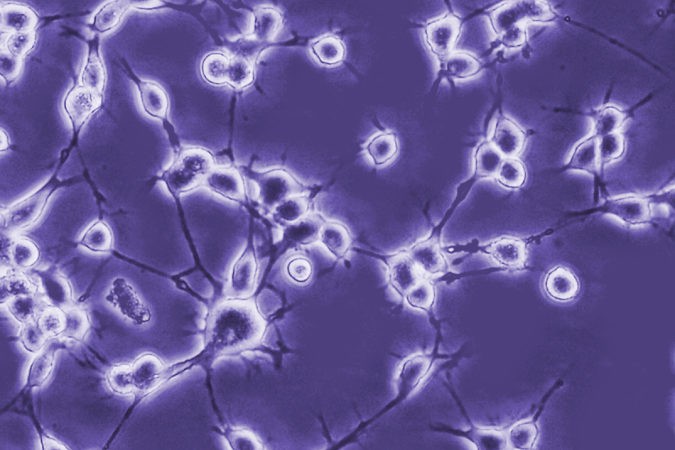 Científicos de Argentina han hallado una molécula clave para transformar células comunes en neuronas