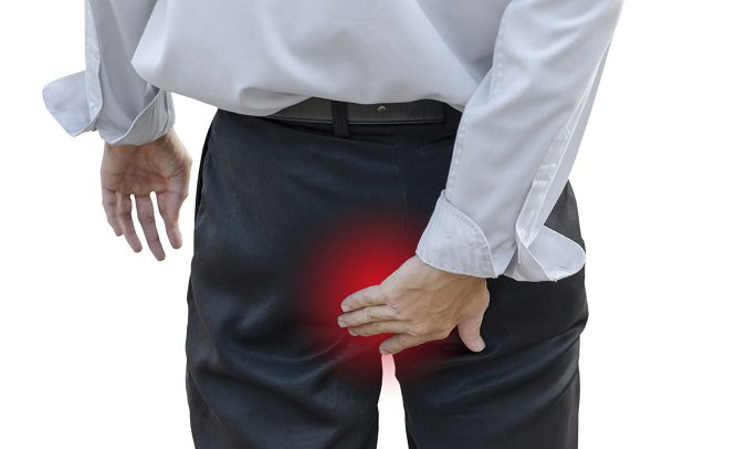 Escoge el remedio casero que mejor te vaya para tratar las hemorroides
