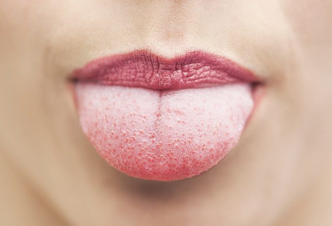 Debes saber por qué tienes la lengua blanca para buscar la solución más acertada