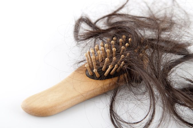 Son muchas a las personas que se les cae el pelo
