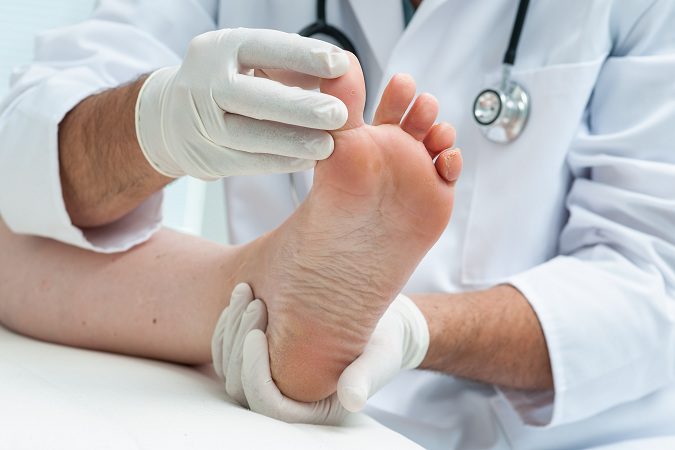 Los pies zambos es un tipo de deformidad de los propios pies