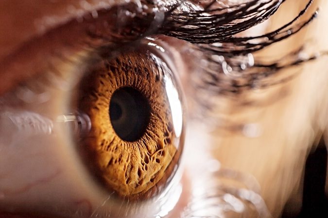 El queratocono es una enfermedad de los ojos muy poco común
