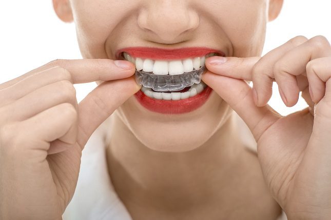 La ortodoncia es el método más popular para lucur unos dientes en perfecto estado