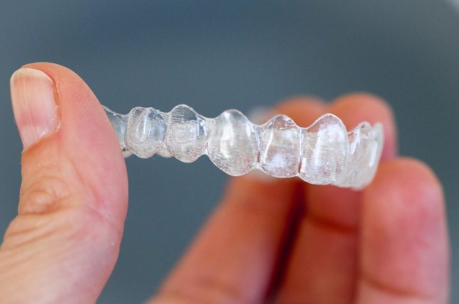 Una alternativa a la molesta ortodoncia son las carillas