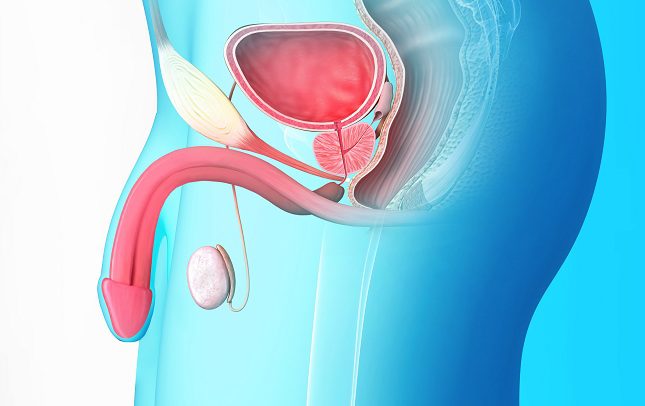 El cáncer de testículo se manifiesta por el aumento del tamaño del propio testículo