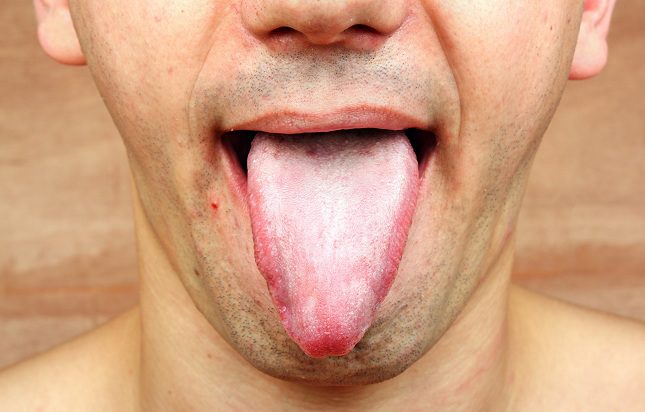 La fatiga es uno de los primeros síntomas de la anemia