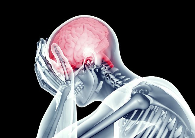 El derrame cerebral es el bloqueo del flujo de sangre en el cerebro