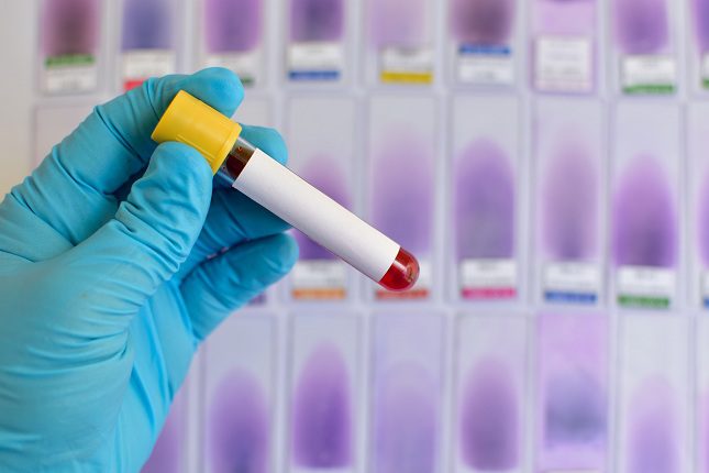 La gente piensa que el virus de la hepatitis C no es muy grave