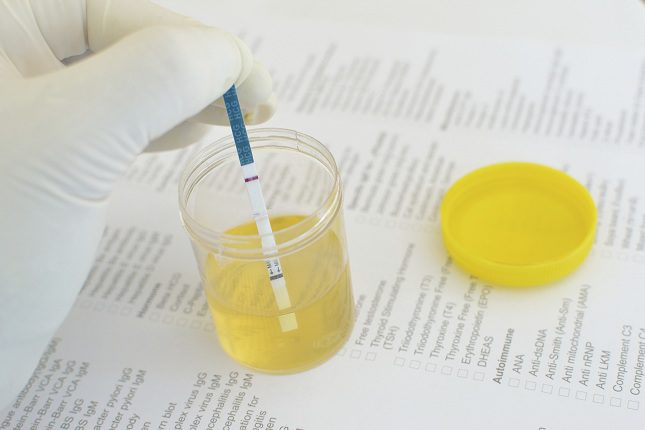 El sedimento de orina es usado para detectar presencia de partículas como microproteínas, hematíes o leucocitos