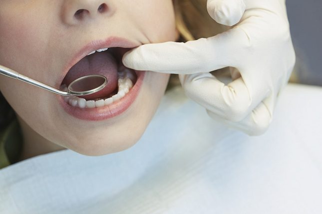 La candidiasis bucal se trata de una infección por hongos de tipo levaduriformes que salen en la lengua