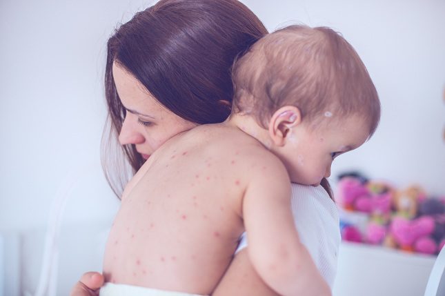 La vacuna se aplica a niños de entre 12 a 18 meses de edad