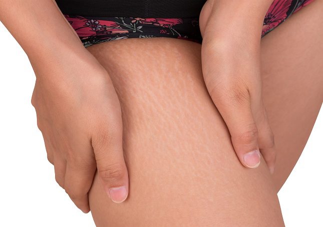 Durante el embarazo, el cuerpo de una mujer sufre multitud de cambios