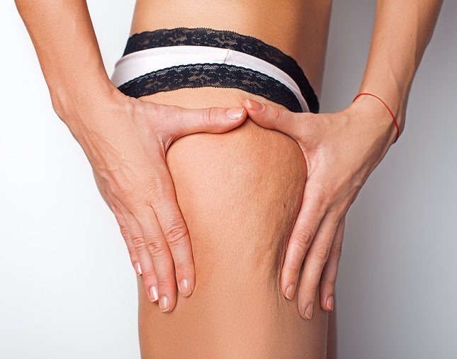 El tratamiento de la flebitis profunda es más complejo que el de la superficial