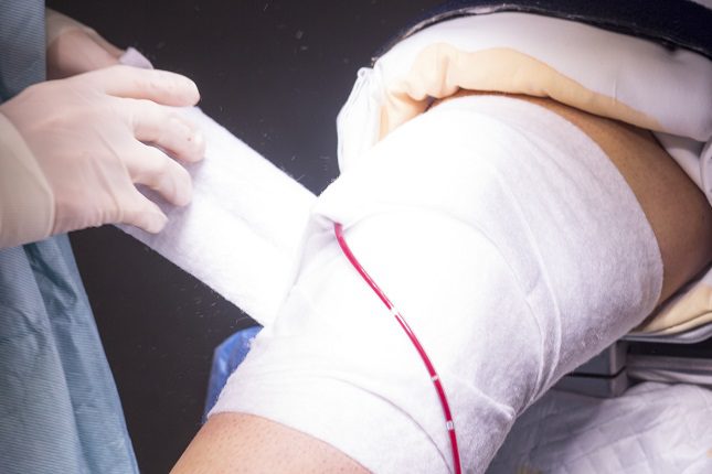 Al tratarse de una intervención, es necesario que el paciente esté ingresado en el hospital