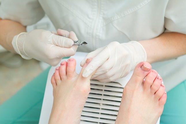 El uñero es una infección de la zona de la cutícula que rodea las uñas tanto de los pies como de las manos