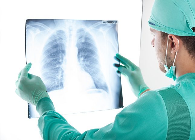 La broncoscopia sirve para que el médico pueda diagnosticar diversas patologías que afectan a las vías respiratorias