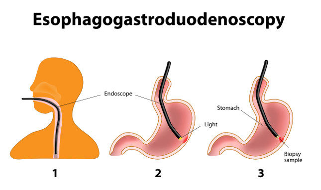 Esta prueba se realiza cuando se necesita hacer una biopsia, pero también en otros casos