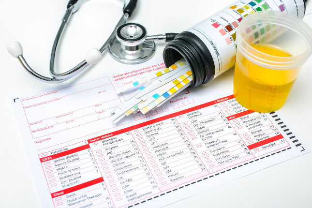 La cistoscopia es una prueba médica para detectar problemas renales