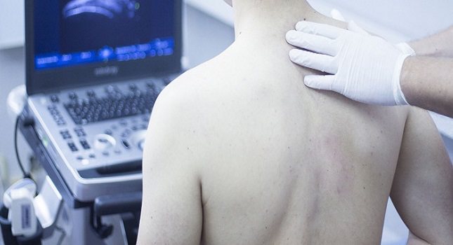La mayoría de la gente piensa que la punción lumbar duele mucho cuando eso no es del todo cierto