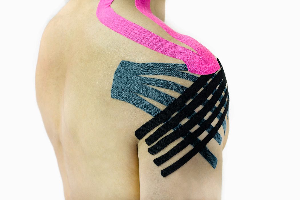 ¿Qué es el kinesiotaping o vendaje neuromuscular?