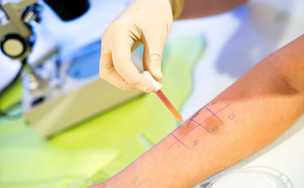 Pruebas cutáneas para detectar alergias