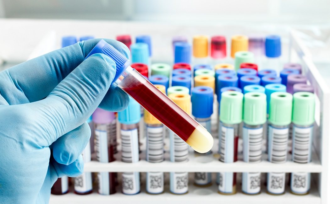 ¿Cuál es la sangre 0 positivo?