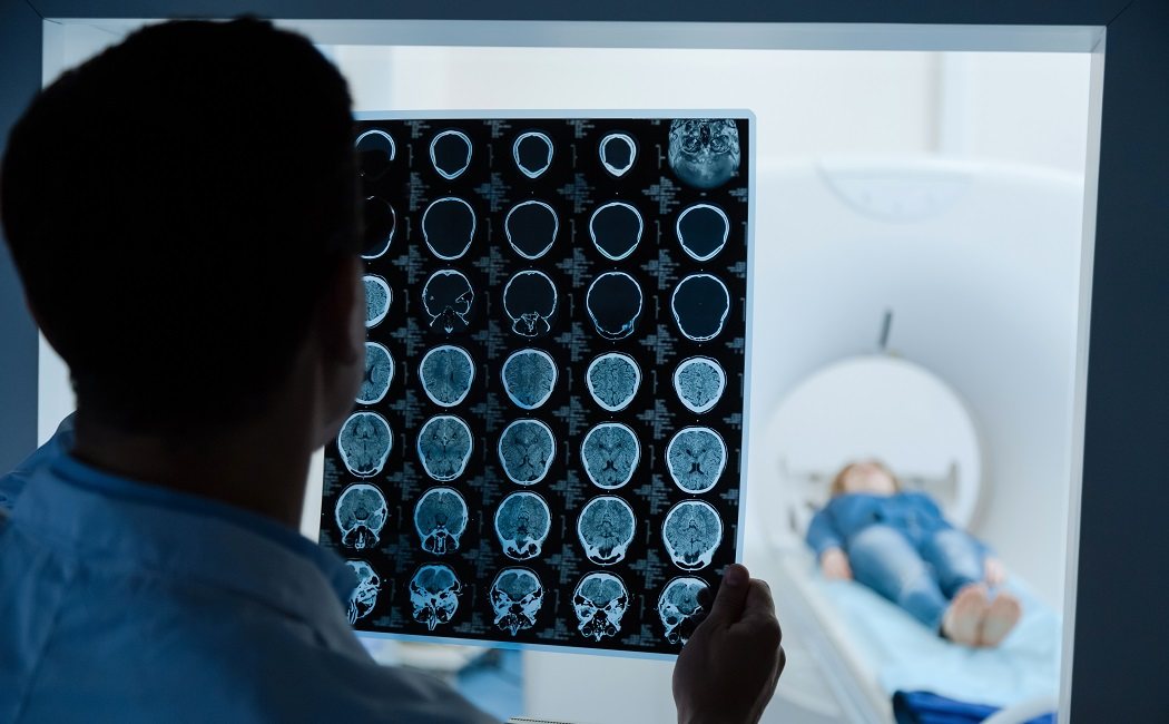 Qué es la demencia frontotemporal o enfermedad de Pick
