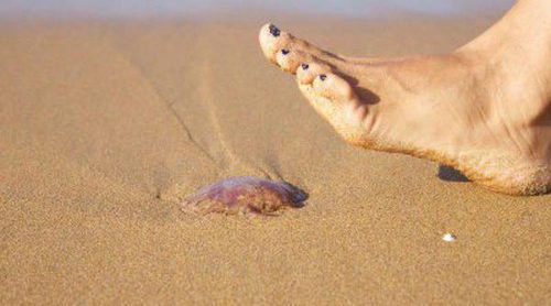 Picaduras en el verano, te explicamos cómo tratarlas