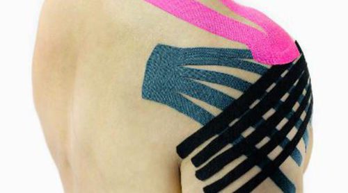 ¿Qué es el kinesiotaping o vendaje neuromuscular?
