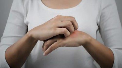 ¿Qué es la dermatitis atópica?
