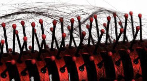 Caída de pelo tras la menopausia.
