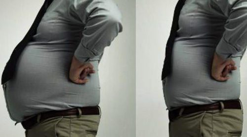 ¿En qué consiste la cirugía bariátrica?
