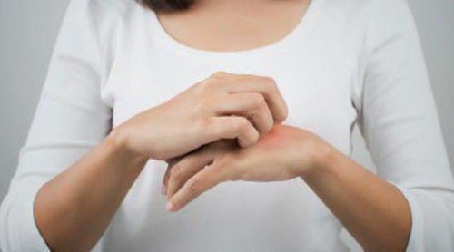 ¿Qué es la dermatitis de contacto?