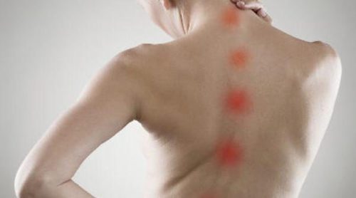 ¿Qué es la escoliosis?