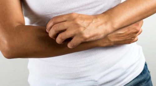 6 medidas para protegerse del virus del Zika