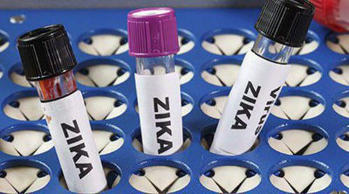 ¿Qué es el virus del Zika?