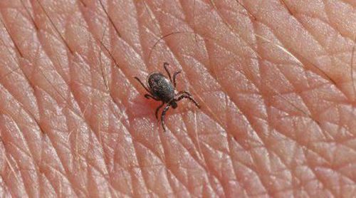 ¿Qué es la enfermedad de Lyme?
