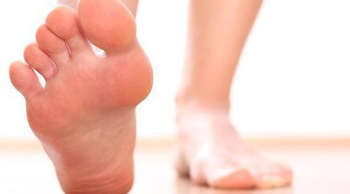 Qué son los pies zambos o equinovaros