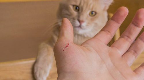 La enfermedad por arañazo de gato
