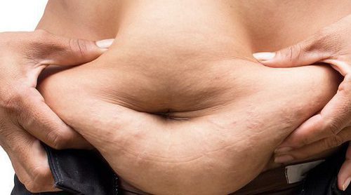 ¿La obesidad está ligada con la muerte prematura?