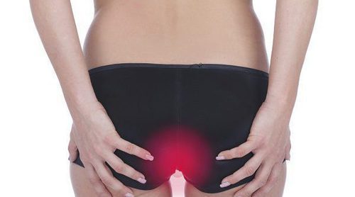 Qué son las hemorroides trombosadas y por qué suceden