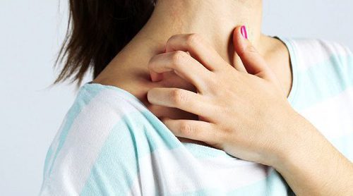 Qué es la alergia al sol
