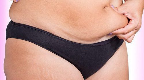 Qué le pasa a tu cuerpo si tienes kilos de más